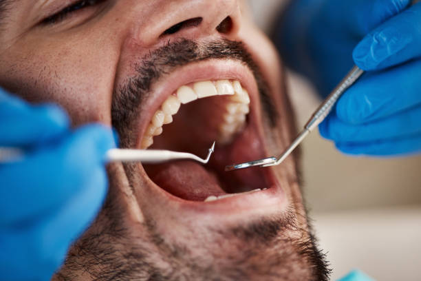 Best Emergency Tooth Extraction in Madison, OH